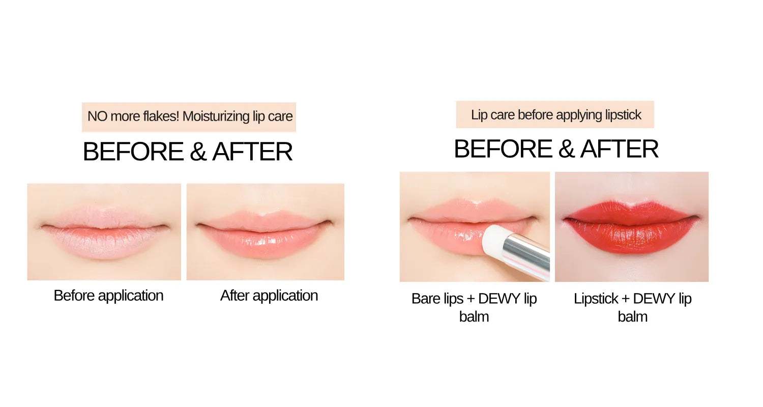 Shop Best Lip Balm for Dark Lips Online In India